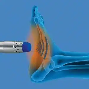 Decompression, manual therapy